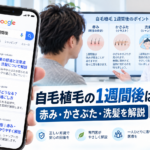 自毛植毛の1週間後はどうなる?赤み・かさぶた・洗髪を解説【2026年最新】