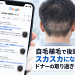 自毛植毛で後頭部がスカスカになる原因|ドナーの取り過ぎを防ぐ方法