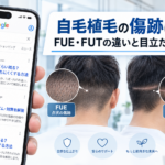 自毛植毛の傷跡は残る?FUE・FUTの違いと目立たなくする方法
