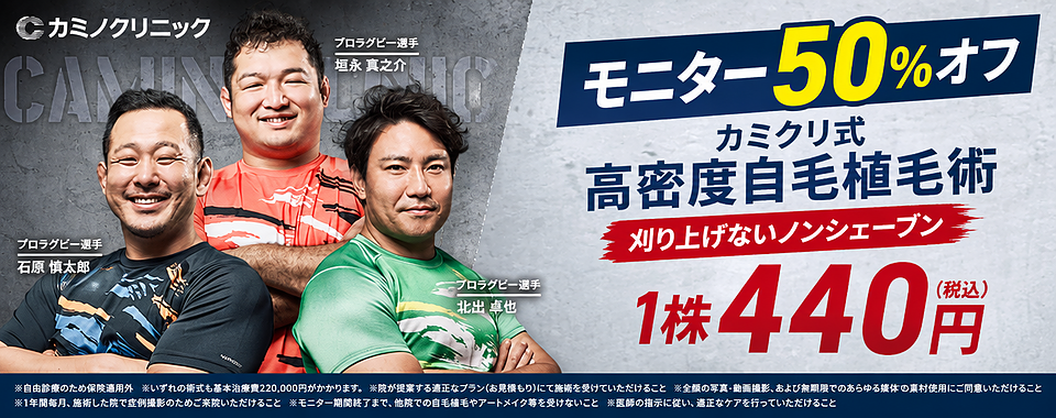 自毛植毛50%オフモニターキャンペーン