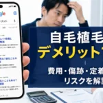 自毛植毛のデメリット10選｜費用・傷跡・定着しないリスクを解説