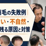 自毛植毛の失敗例｜生えない・不自然・傷跡が残る原因と対策