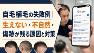 自毛植毛の失敗例｜生えない・不自然・傷跡が残る原因と対策