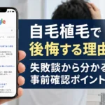 自毛植毛で後悔する理由は？失敗談から分かる事前確認ポイント